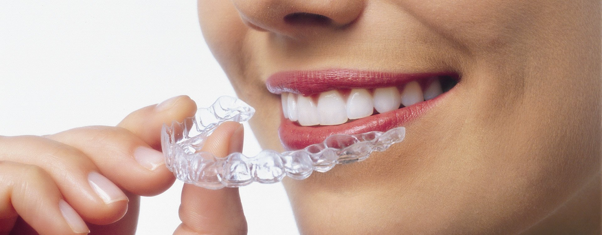 Tandretning med Invisalign