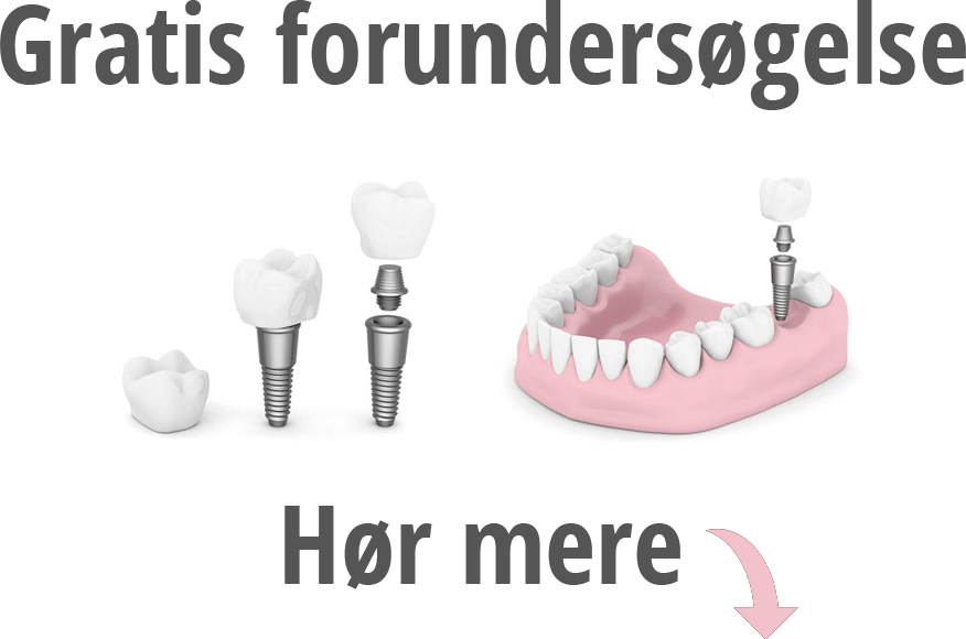 Gratis forundersøgelse